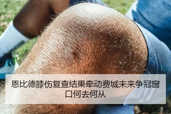 恩比德膝伤复查结果牵动费城未来争冠窗口何去何从